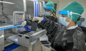 Centro Nacional de Genética Medica, Laboratorio de Biología molecular, procesamiento de muestras ADN