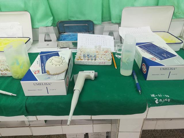 UMELISA SARS CoV-2 IgG