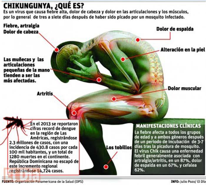VIRUS DEL CHIKUNGUNYA