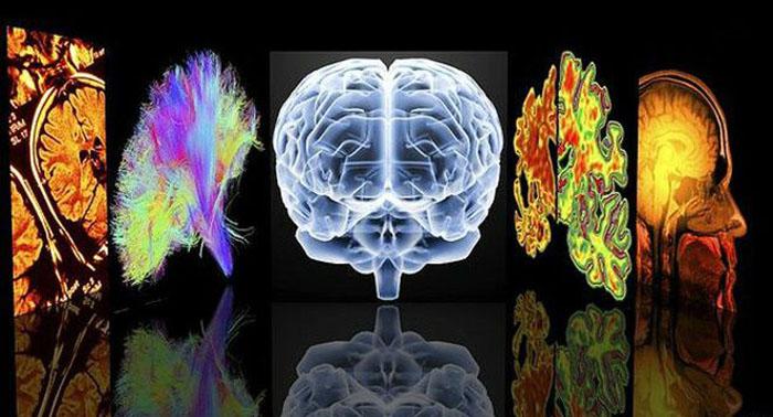 Alzheimer