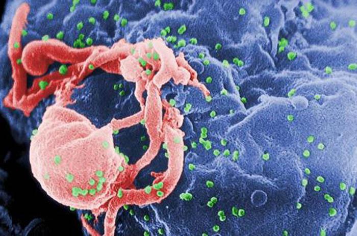 virus sida vih
