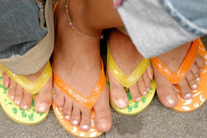 El uso frecuente de las chancletas se relaciona con la fascitis plantar y altera además la forma de caminar