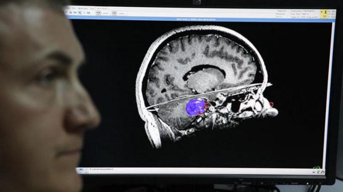Crean cerebro artificial capaz de aprender por sí mismo
