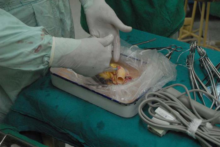 Trabajo de banco para preimplante del corazón 