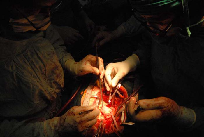 Inicio del trasplante