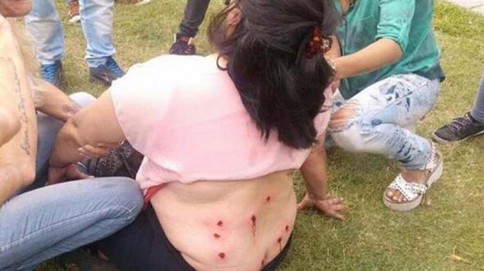 La mujer identificada como Ana María recibió 9 disparos en la espalda (en la foto solo se ven ocho).