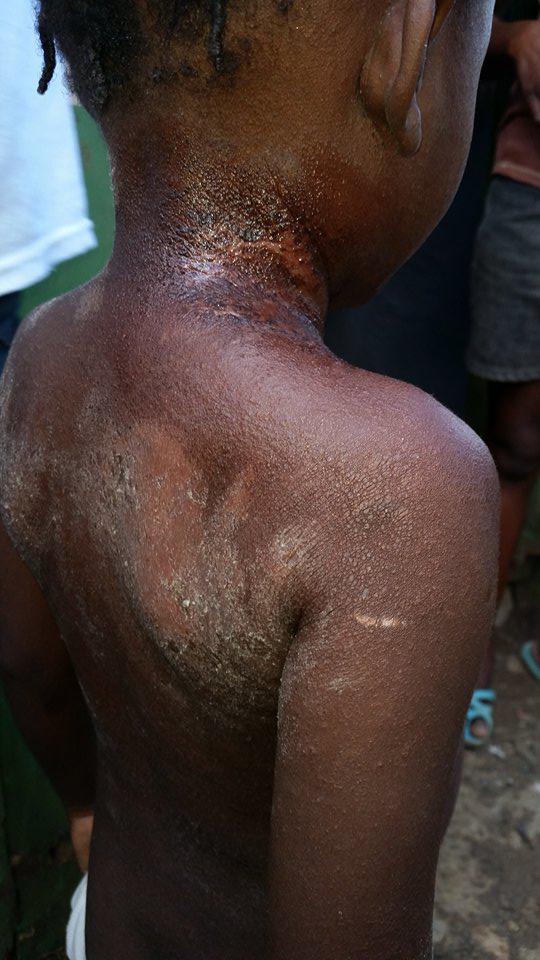 Médicos de la brigada Henry Reeve en el sur de Haití