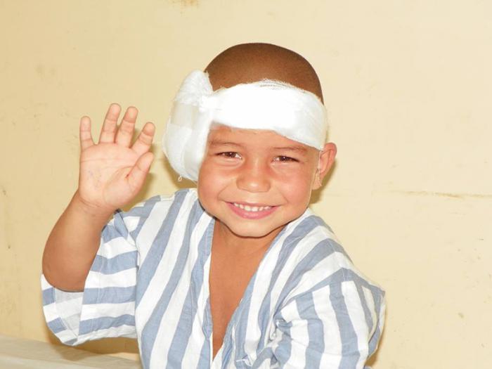 El niño Hexon, 24 horas después de ser implantado