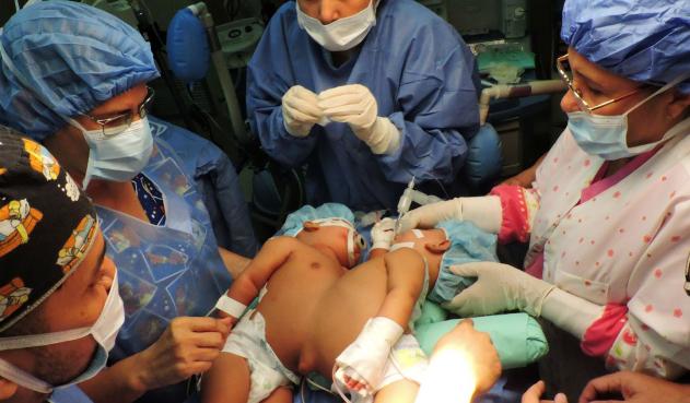 Las siamesas Ana Ruth y Ana Saray Pertuz mientras son operadas en el Hospital Universitario de Maracibo, en Venezuela. foto: AFP