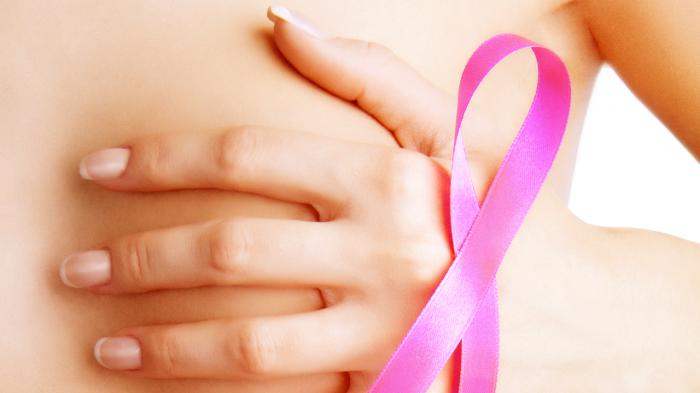 Modernas terapias contra el cáncer de mamas en Ciego de Ávila