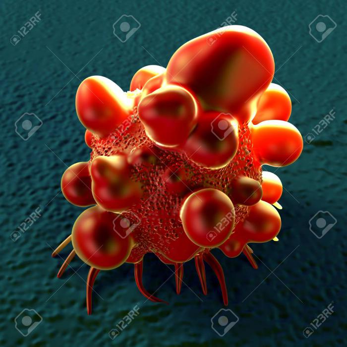 Ilustración de una célula de cáncer intestinal