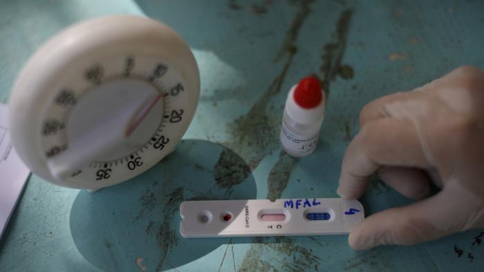 SARS-CoV-2 podría sobrevivir en el agua hasta 25 días, indica estudio preliminar