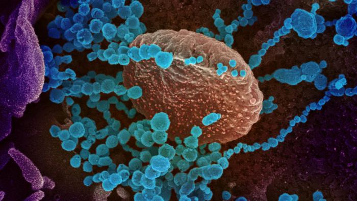 El SARS-CoV-2 (azul) invade células humanas, cultivadas en el laboratorio / Imagen microscópica coloreada.