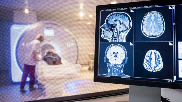 Al menos tres de los siete coronavirus que atacan al ser humano, incluido el SARS-COV-2, tienen capacidad neuroinvasiva demostrada, al detectarse ARN viral o ácidos nucleicos en el cerebro de las personas. 