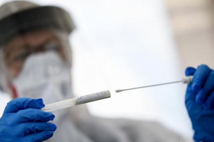 Test de Antígeno para detectar la COVID-19