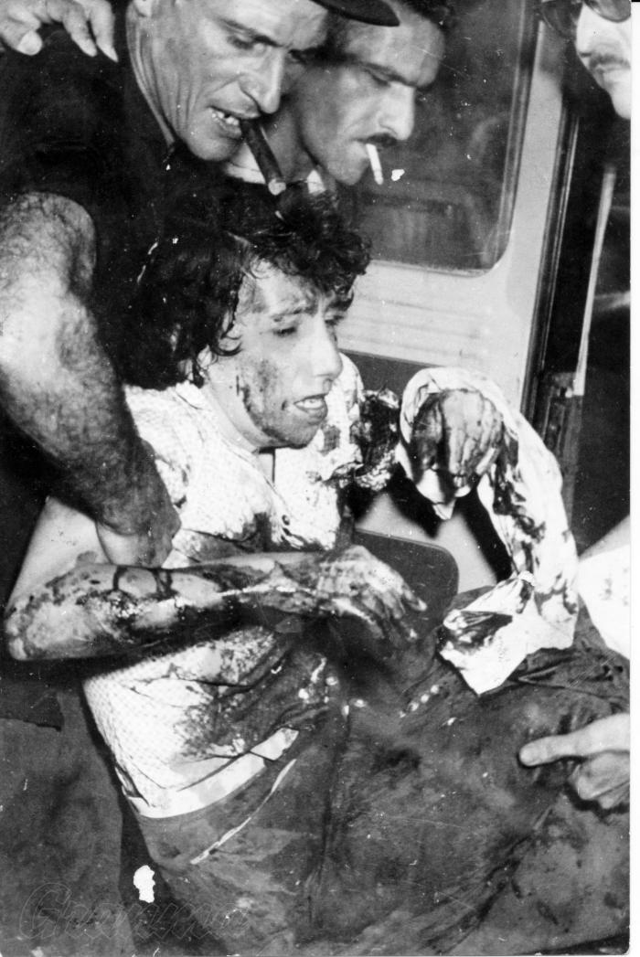 Emilia Guerra Brito, pasajera del omnibus que quedó detenido frente al Palacio Presidencial el 13 de marzo de 1957, herida de 10 balazos.
Foto: Archivo