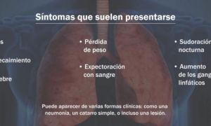tuberculosis