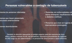 tuberculosis