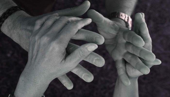 Según datos del Ministerio de Salud Pública, en Cuba hay más de 3 100 personas con sordoceguera, de ellas se encuentran asociadas 891 entre la ANCI y la ANSOC