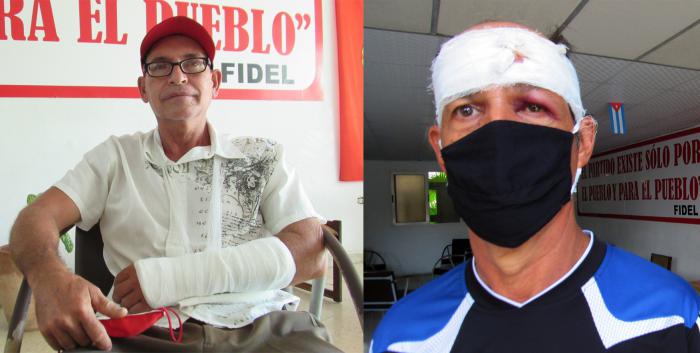 Eddy Rodríguez Ramírez y  Amado Torres Pupo,ambos heridos cuando enfrentaron a los vándalos contrarrevolucionarios que atacaron la sede del Comité Provincial del Partido en Holguín. fotos: germán veloz
