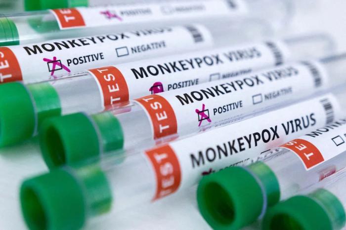 Virus Viruela del Mono