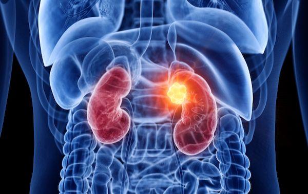 Nuevo estudio entre el CIM y el Rosswell Park