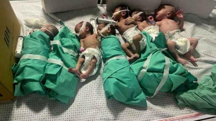 Niños muertos por desnutrición en Palestina