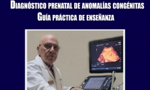 diagnostico-prenatal-de-anomalias-congenitas