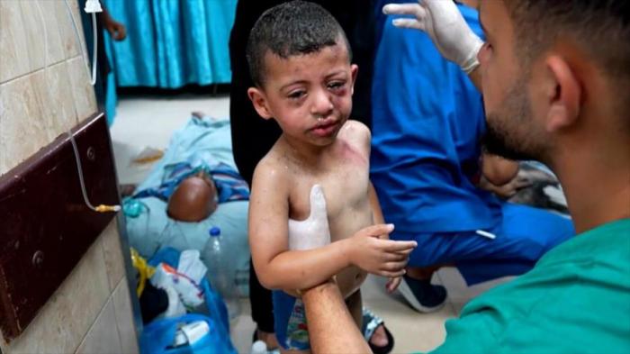 Un niño herido gazatí recibe tratamiento médico en el hospital Al-Aqsa tras un ataque israelí, 2024. 