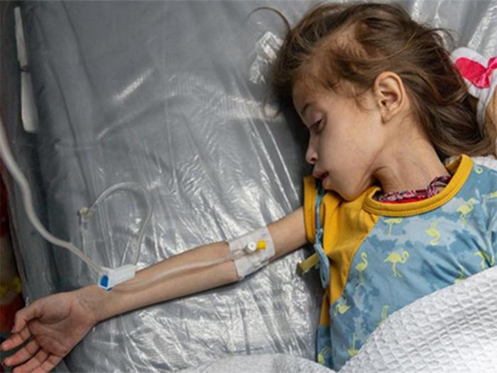 desnutrición infantil en Gaza