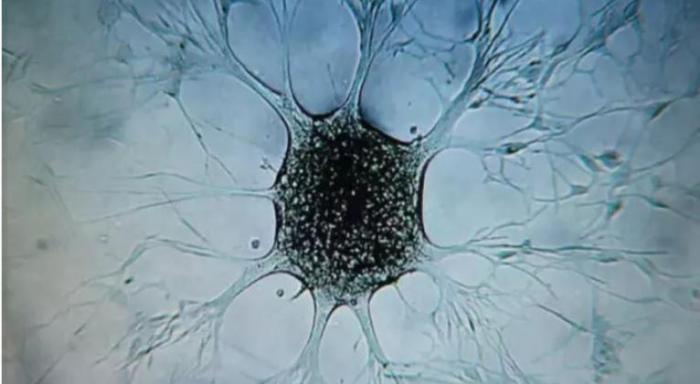 terapia para frenar el cáncer cerebral