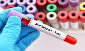 VIRUELA SÍMICA DEJA DE SER UNA EMERGENCIA SANITARIA INTERNACIONAL