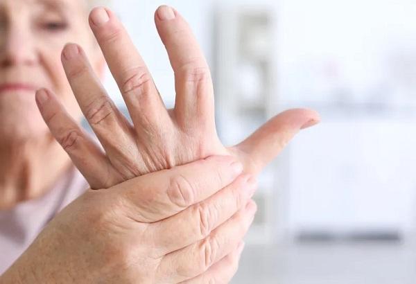 manos-artritis-artrosis-inflamacion
