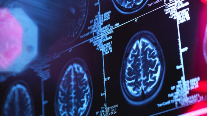  técnica de ultrasonido