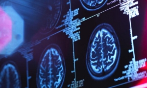  técnica de ultrasonido