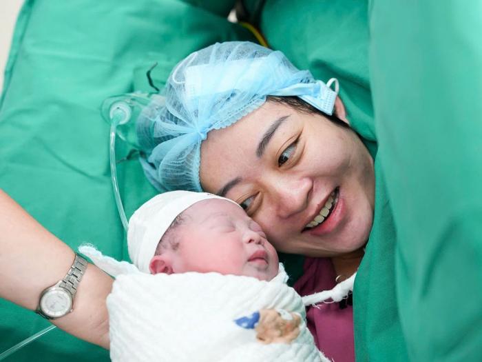 primer bebé US-HIFU