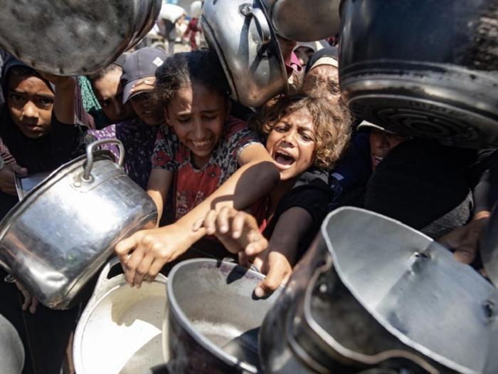  hambre y desnutrición en Gaza