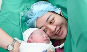 primer bebé US-HIFU