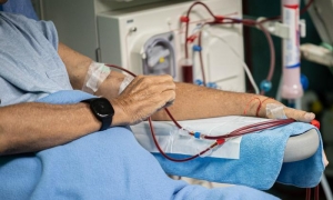 hemodialisis